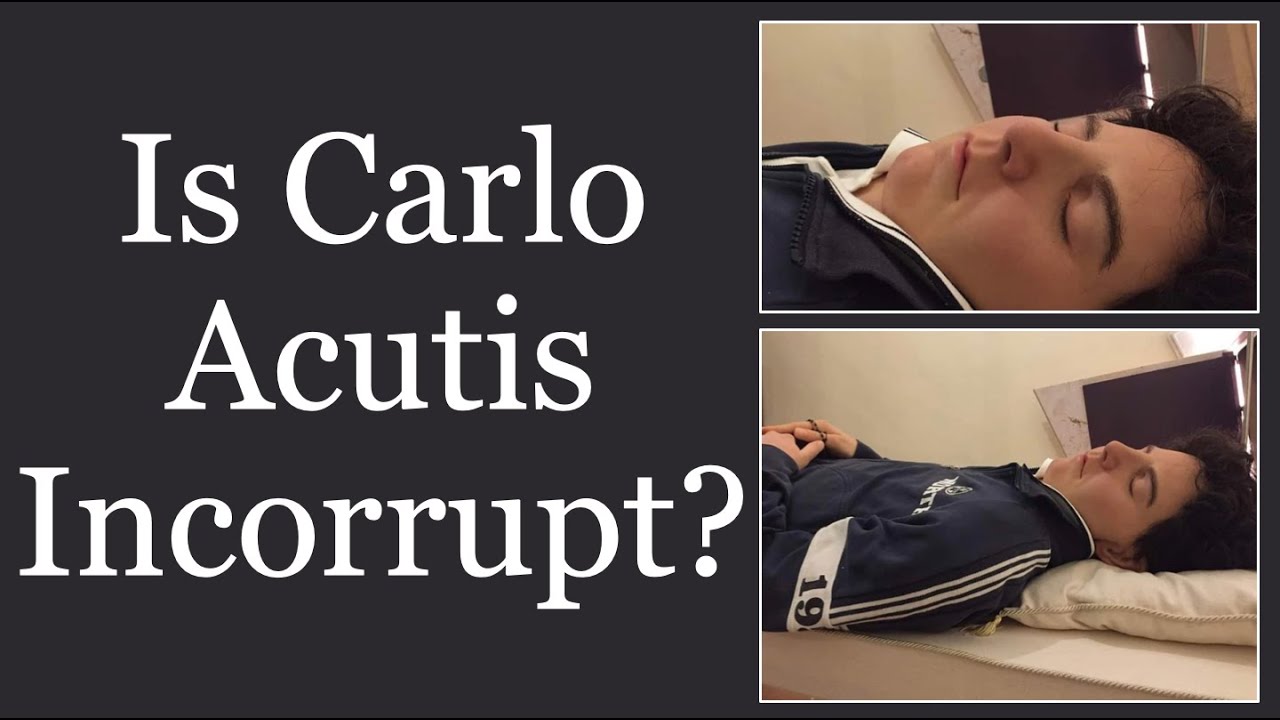 carlo acutis body