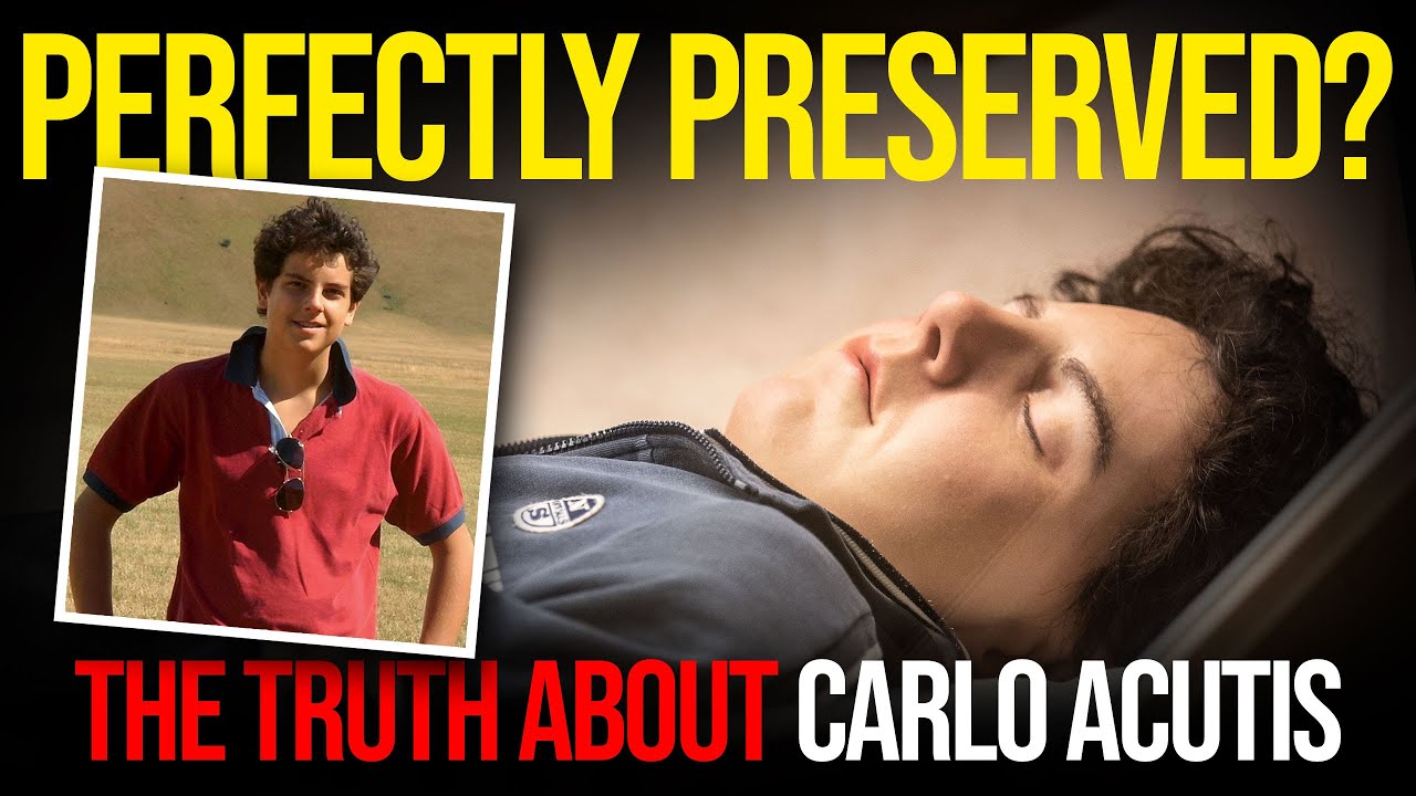 how did they preserve carlo acutis