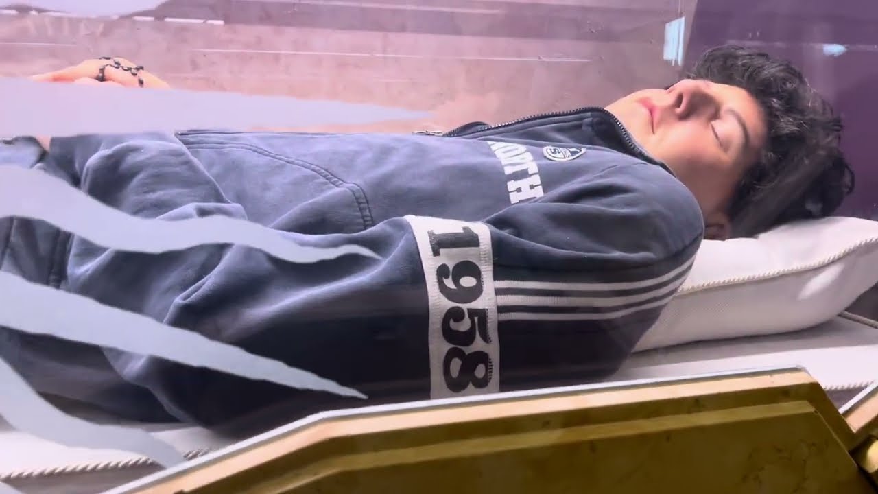 how was carlos acutis body preserved