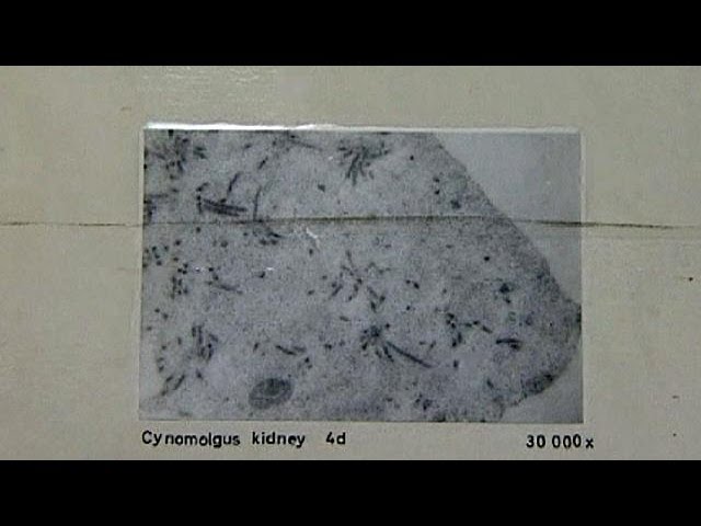 febbre emorragica
