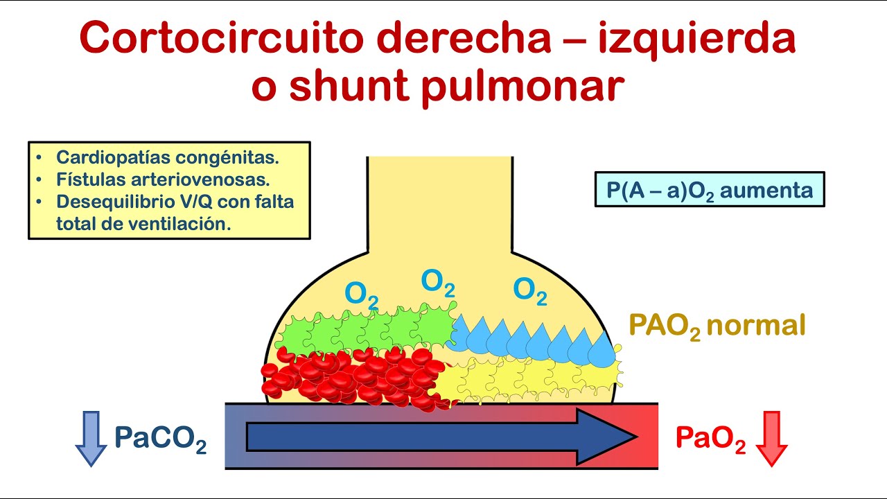 Insuficiência respiratória: 7 sinais que não devem ser ignorados 4 insuficiencia respiratoria