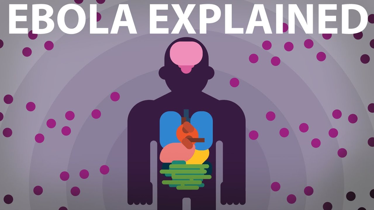 ebola