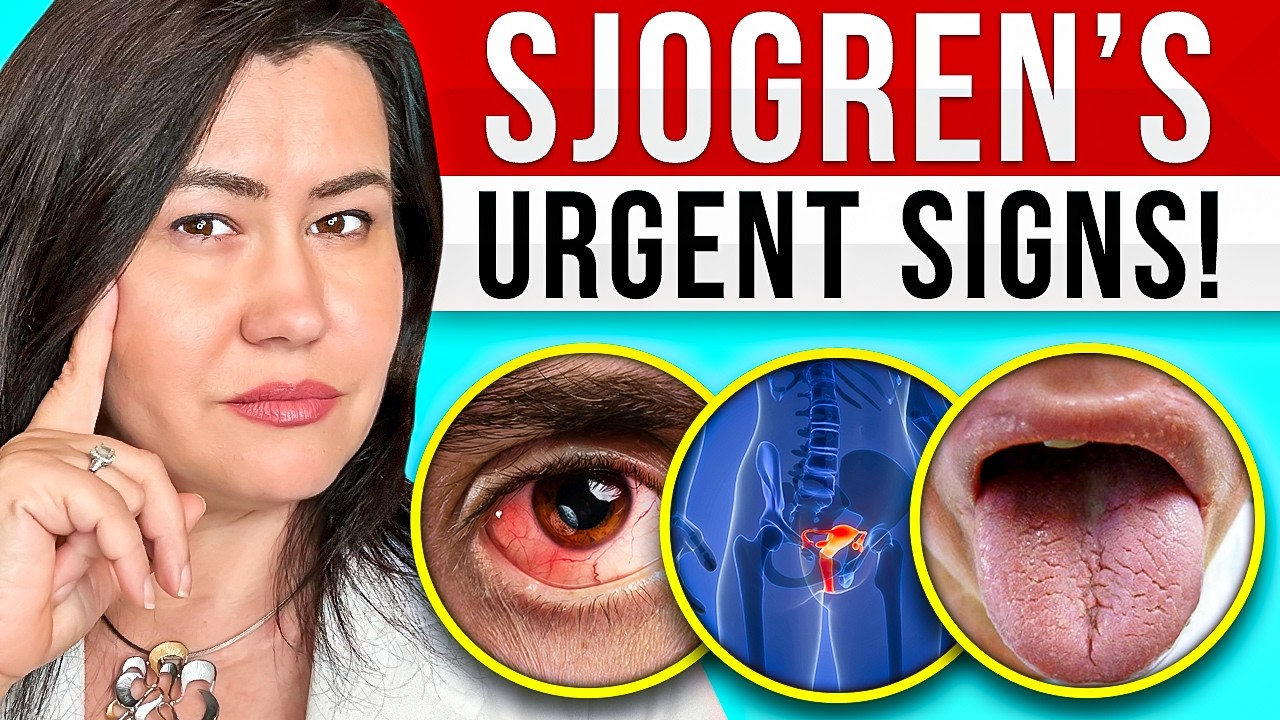 sjögrens