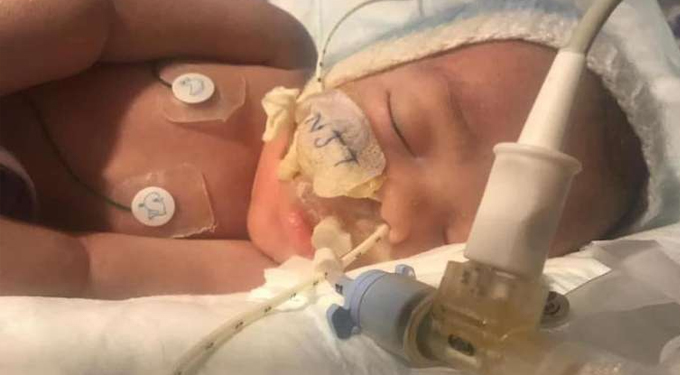 Retiran a un bebé del ventilador después de la controvertida decisión de "muerte del tronco cerebral"